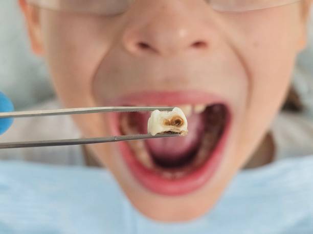 Best Pediatric Emergency Dentist in Naco, AZ